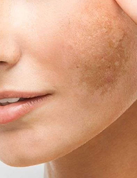 Eloisa Ayres | Skin Clinic